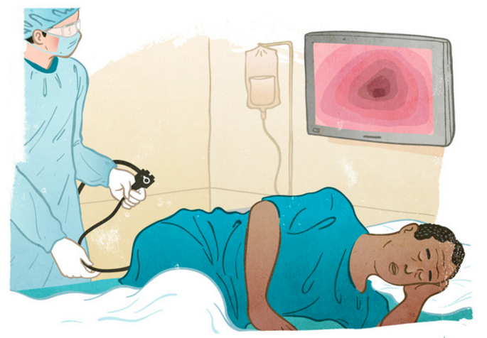 COLONOSCOPY – WHAT IT’S LIKE BEFORE, DURING AND AFTER COLONOSCOPY