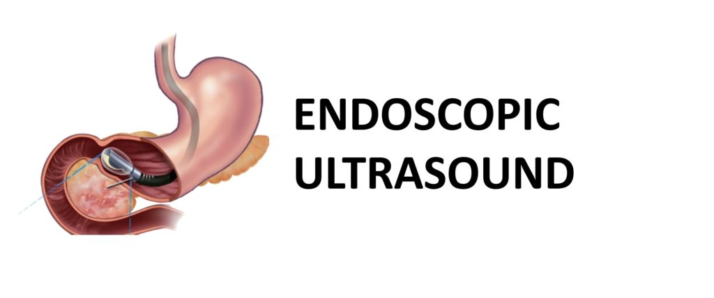 endoscopic_ultrasound